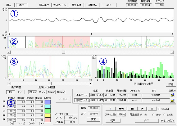 高性能脳波解析PCソフト「パルラックス・プロ」の画面。