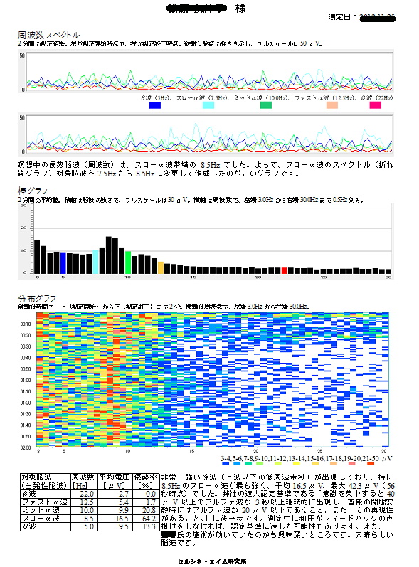脳波解析PCソフト「パルラックス・プロ」と「パルラックスＦ」のグラフを用いた脳波測定結果のレポート例。