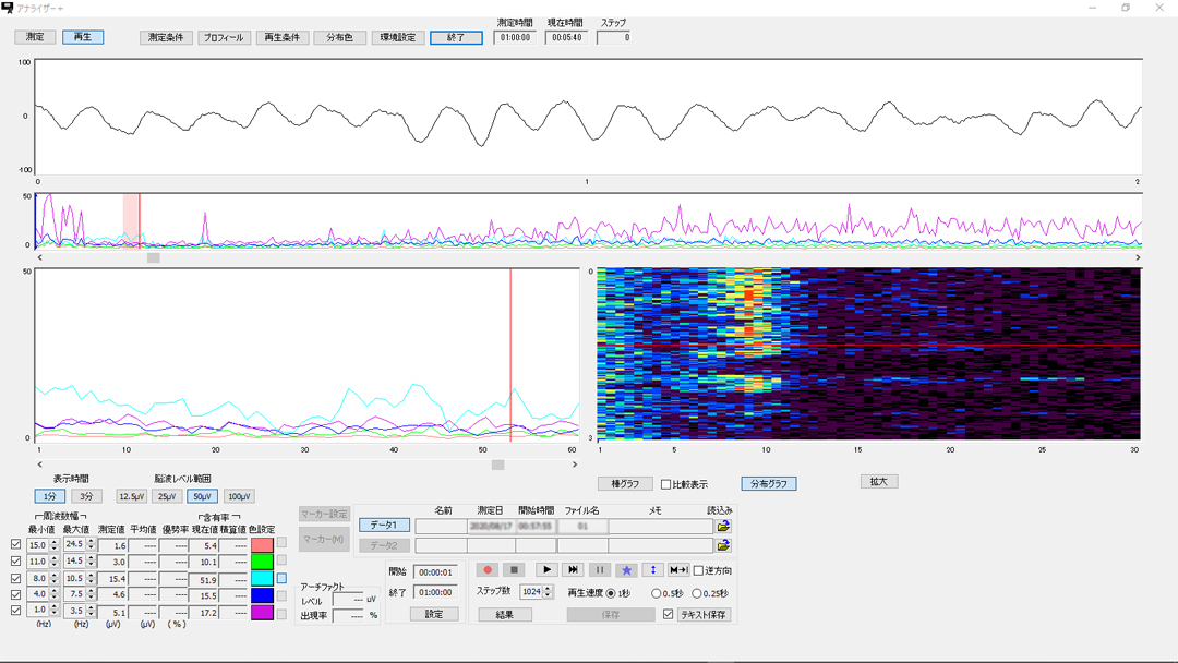 脳波解析PCソフト「アナライザープラス」の画面