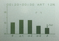 BrainPro「FM-929」本体のトレーニングモード「棒グラフ画面」
